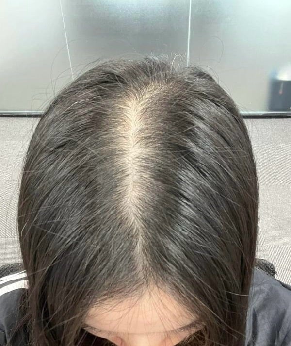 百合子ウィッグ ヘアピースサイズ選びの写真集① | 百合子ウィッグ