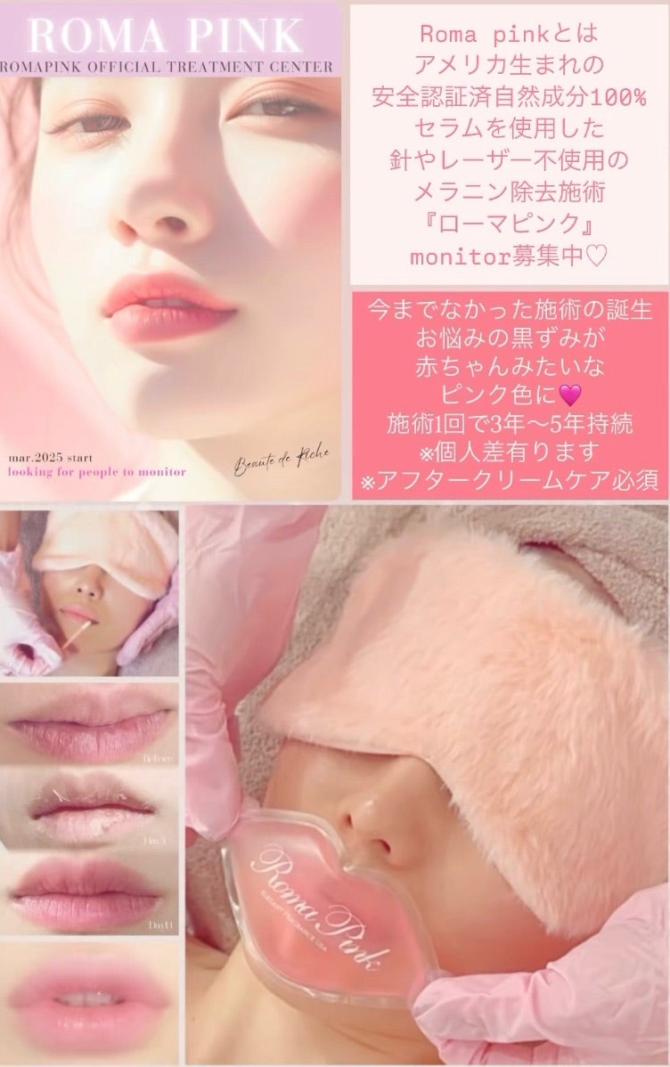 ローマピンク❤️でナチュラルピンクの唇に | ローマピンク・レモン
