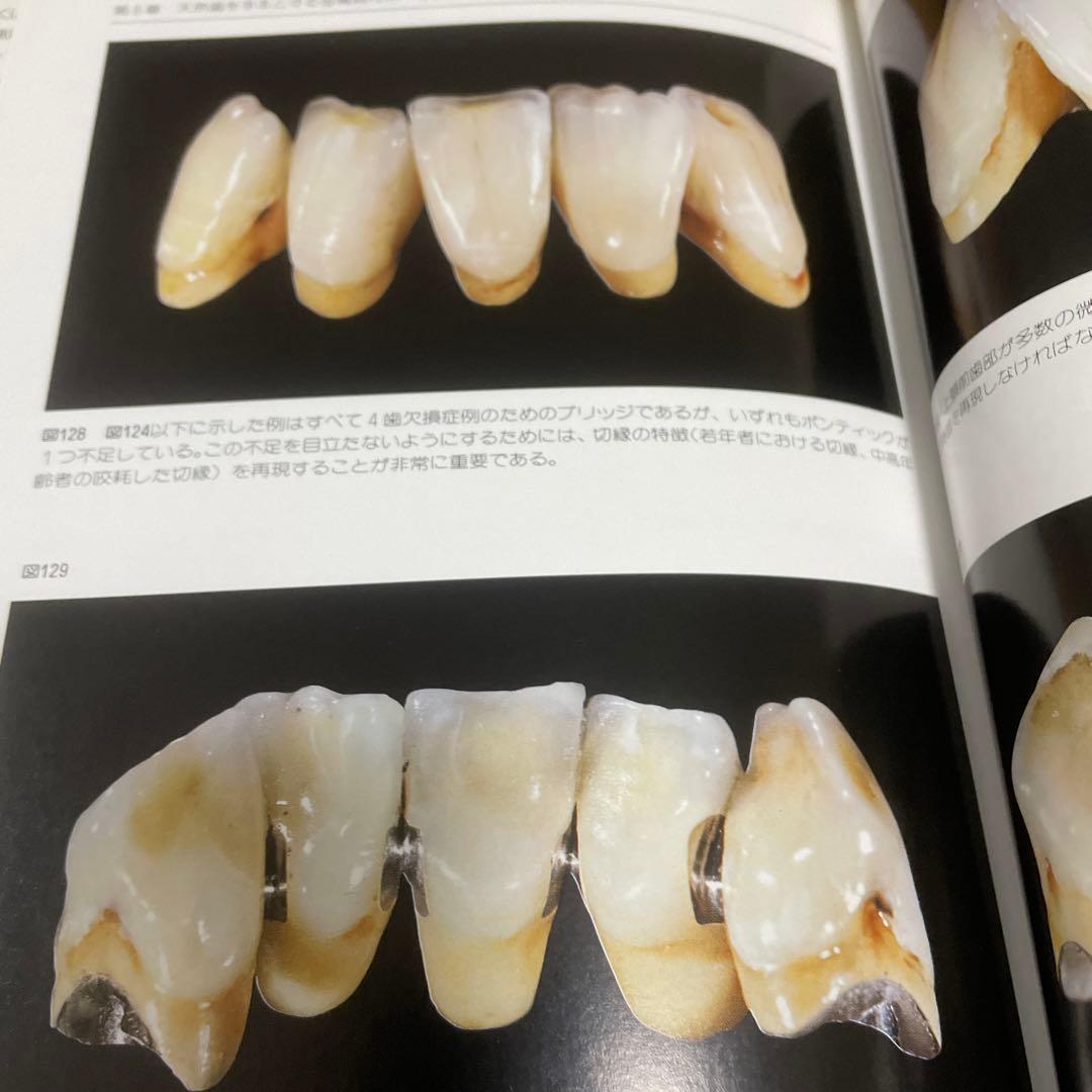 山本眞 監訳 金属焼付ポーセレン・下顎前歯部の審美的表現法 - メルカリ