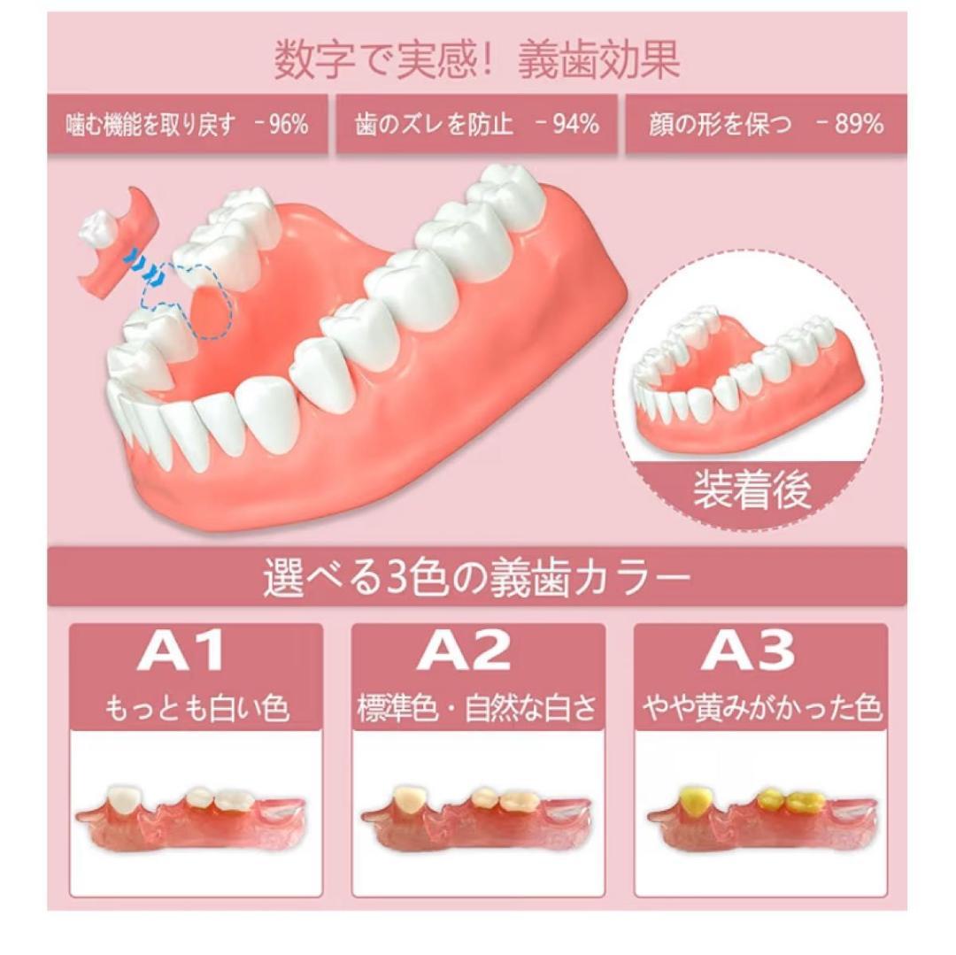 セルフフィッティング 仮歯 歯型採取キット付 カスタマイズ 1本 欠損