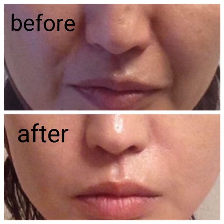 《定価¥289,000 》業務用 LED led マスク 美容 機器 美顔器