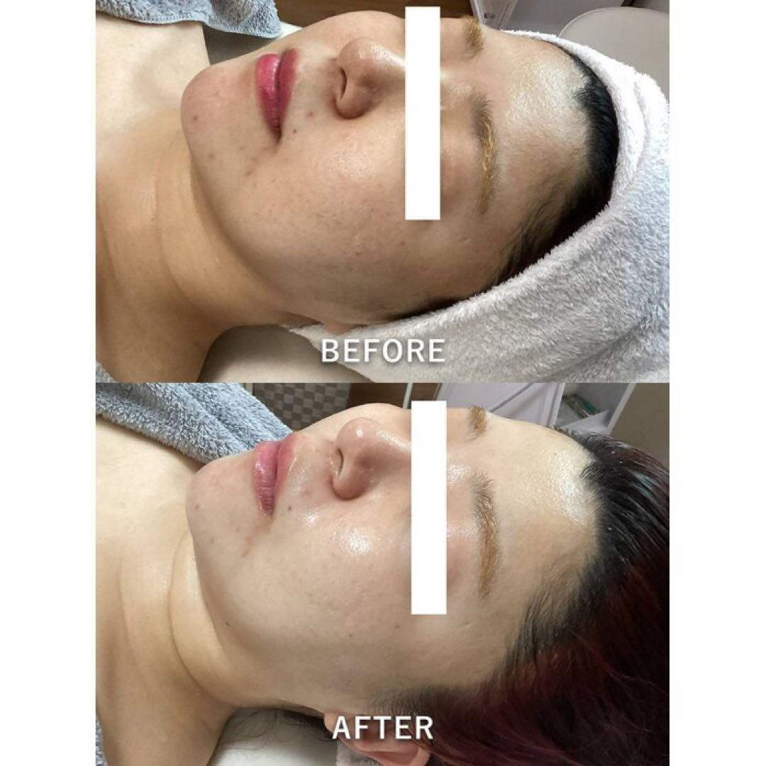 専用出品 もえか様