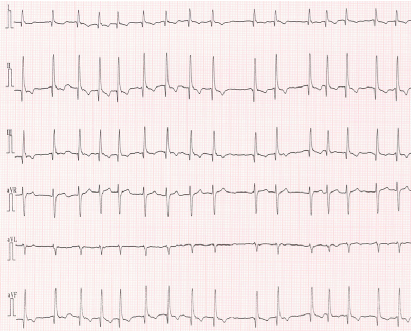 犬の僧帽弁閉鎖不全症 - 東京都杉並区 荻窪の動物病院｜杉並動物循環器